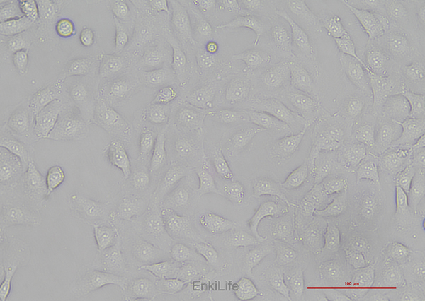 人膀胱癌细胞5637(STR鉴定) | EnkiLife恩玑生命