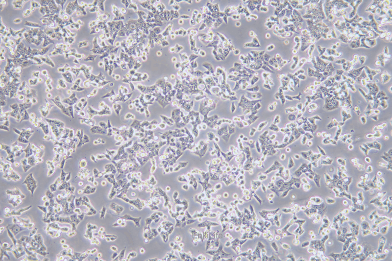 人膀胱癌细胞BIU-87(STR鉴定) | EnkiLife恩玑生命