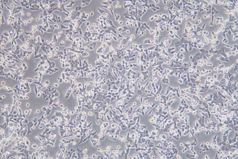 人膀胱癌细胞BIU-87(STR鉴定) | EnkiLife恩玑生命