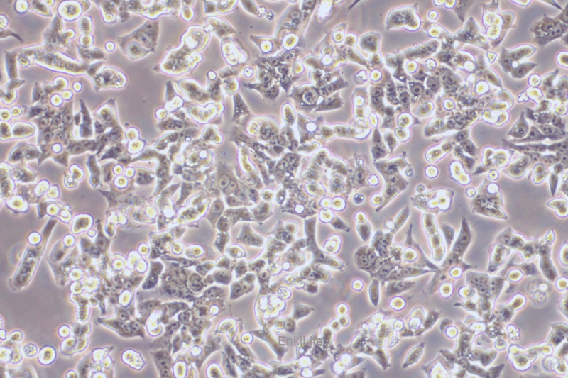 人膀胱癌细胞BIU-87(STR鉴定) | EnkiLife恩玑生命