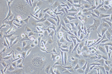 人膀胱癌细胞EJ-1(STR鉴定) | EnkiLife恩玑生命