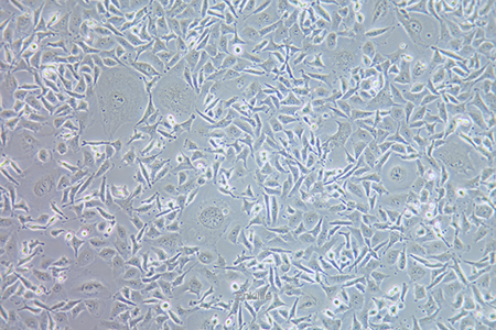 人膀胱癌细胞EJ-1(STR鉴定) | EnkiLife恩玑生命
