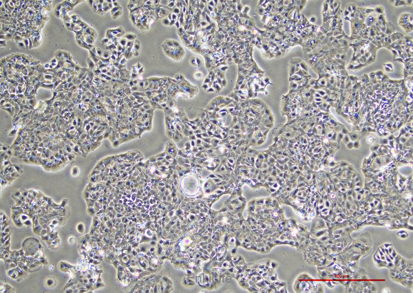 人膀胱癌细胞HT-1376(STR鉴定) | EnkiLife恩玑生命