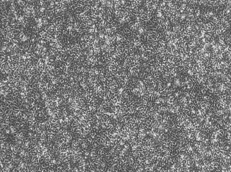 人膀胱癌细胞RT112(STR鉴定) | EnkiLife恩玑生命