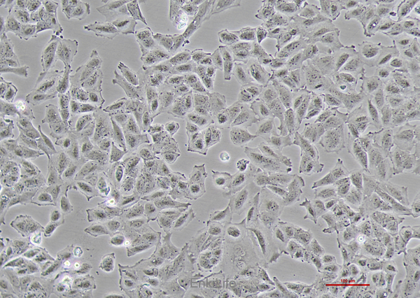 人膀胱癌细胞TCCSUP(STR鉴定) | EnkiLife恩玑生命