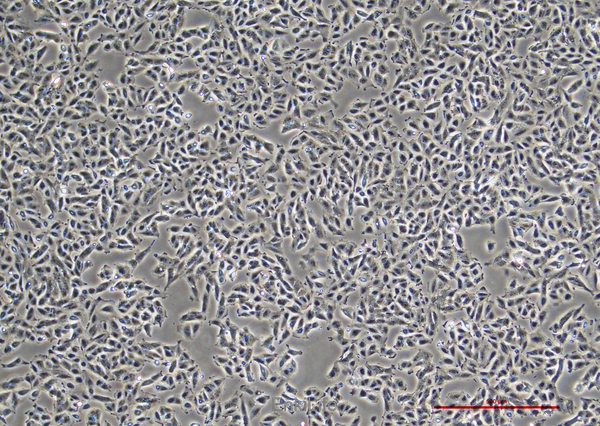人膀胱癌细胞TCCSUP(STR鉴定) | EnkiLife恩玑生命