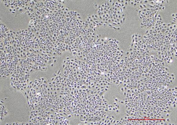 人膀胱鳞癌细胞SCaBER(STR鉴定) | EnkiLife恩玑生命