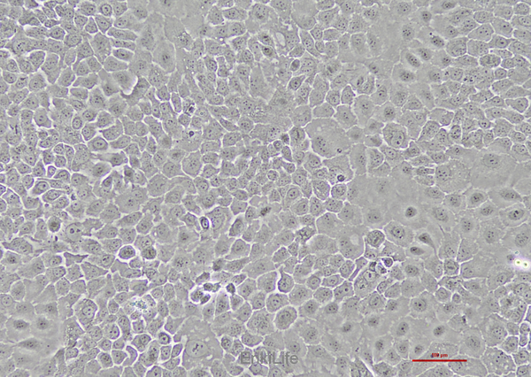 人膀胱鳞癌细胞SCaBER(STR鉴定) | EnkiLife恩玑生命
