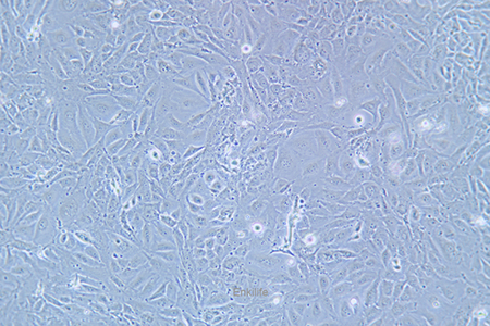 人膀胱移行细胞癌J82(STR鉴定) | EnkiLife恩玑生命