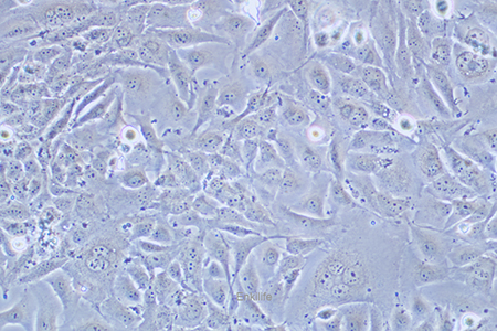 人膀胱移行细胞癌J82(STR鉴定) | EnkiLife恩玑生命
