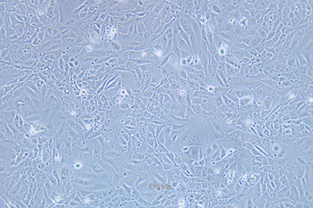 人膀胱移行细胞癌J82(STR鉴定) | EnkiLife恩玑生命