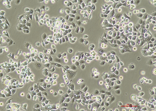 人膀胱移行细胞癌SW780(STR鉴定) | EnkiLife恩玑生命