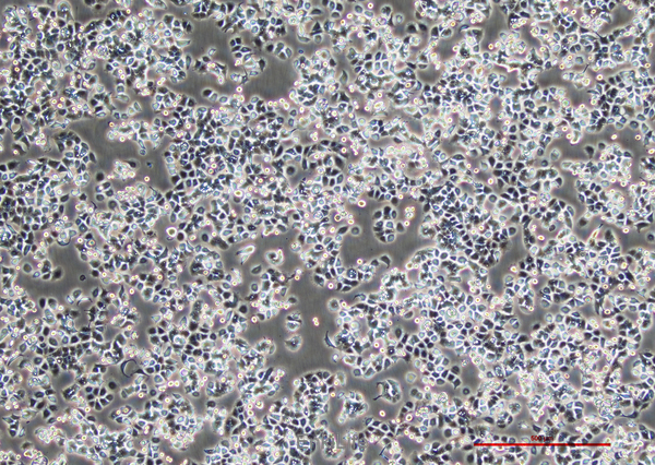 人膀胱移行细胞癌SW780(STR鉴定) | EnkiLife恩玑生命