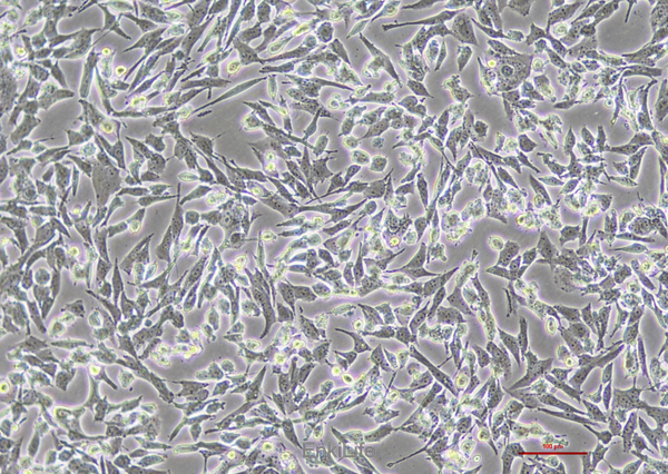 人膀胱移行细胞癌UM-UC-3(STR鉴定) | EnkiLife恩玑生命