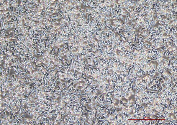 人膀胱移行细胞癌UM-UC-3(STR鉴定) | EnkiLife恩玑生命