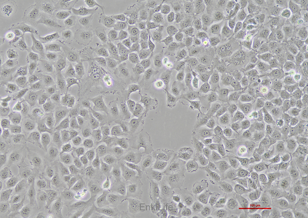 人膀胱移行细胞癌细胞T24(STR鉴定) | EnkiLife恩玑生命