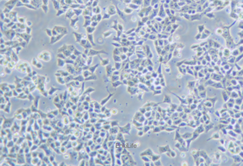人鼻腔上皮细胞RPMI 2650(STR鉴定) | EnkiLife恩玑生命