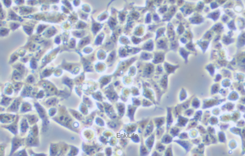 人鼻腔上皮细胞RPMI 2650(STR鉴定) | EnkiLife恩玑生命