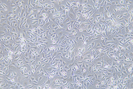 人鼻咽癌细胞HNE1(STR鉴定) | EnkiLife恩玑生命