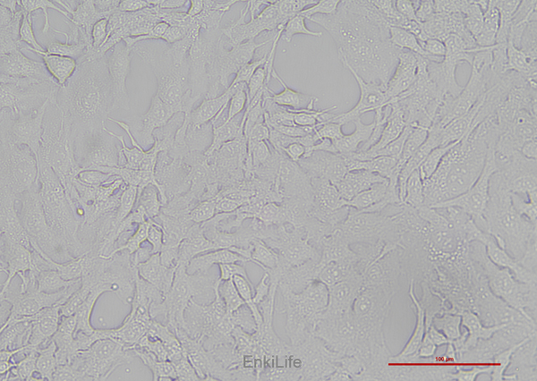 人胆管细胞型肝癌细胞Hccc9810(STR鉴定) | EnkiLife恩玑生命