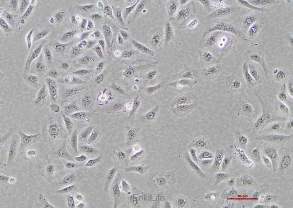 人胆囊癌细胞GBC-SD(STR鉴定) | EnkiLife恩玑生命