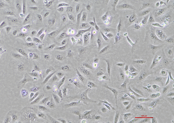 人胆囊癌细胞GBC-SD(STR鉴定) | EnkiLife恩玑生命