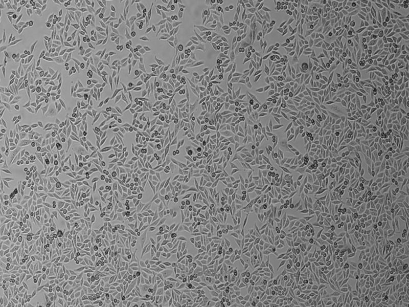 人低分化肺腺癌细胞SK-LU-1(STR鉴定) | EnkiLife恩玑生命