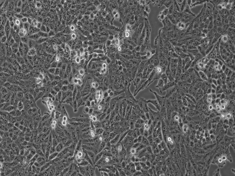 人低分化肺腺癌细胞SK-LU-1(STR鉴定) | EnkiLife恩玑生命