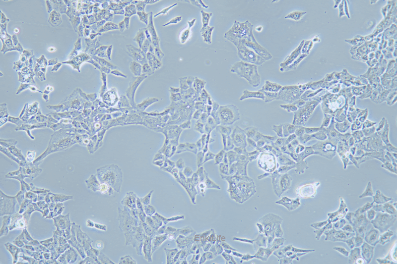 人骶骨脊索瘤细胞MUG-Chor1(STR鉴定) | EnkiLife恩玑生命