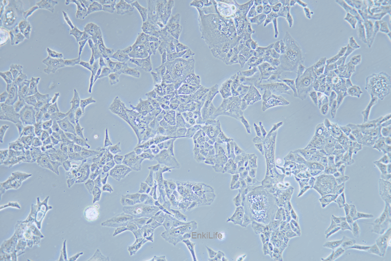 人骶骨脊索瘤细胞MUG-Chor1(STR鉴定) | EnkiLife恩玑生命