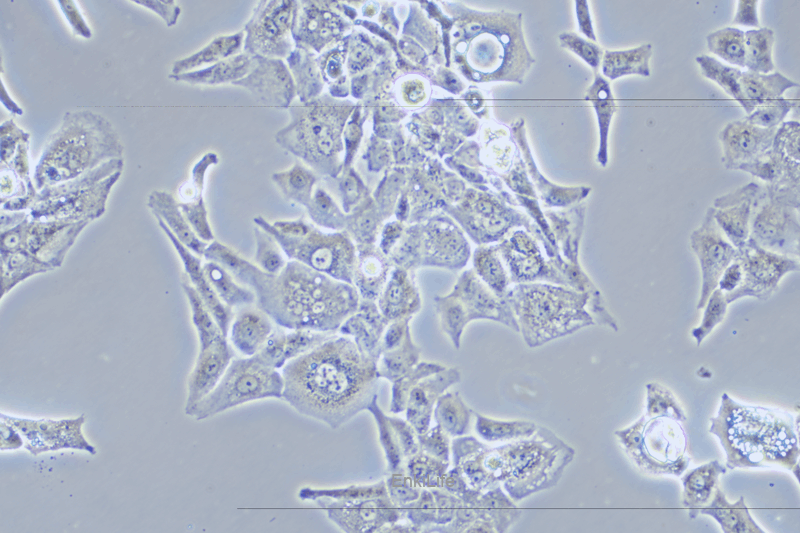 人骶骨脊索瘤细胞MUG-Chor1(STR鉴定) | EnkiLife恩玑生命