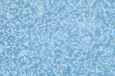 人恶性非霍奇金淋巴瘤患者的自然杀伤细胞NK92(STR鉴定) | EnkiLife恩玑生命