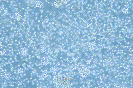 人恶性非霍奇金淋巴瘤患者的自然杀伤细胞NK92(STR鉴定) | EnkiLife恩玑生命