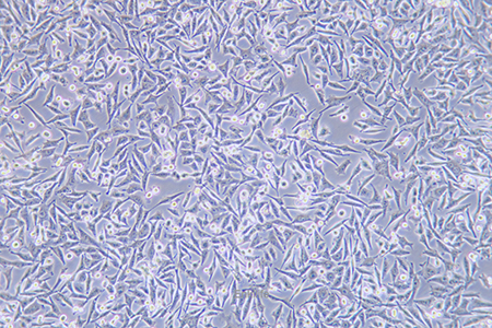 人恶性黑色素瘤细胞A375(STR鉴定) | EnkiLife恩玑生命