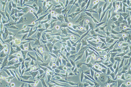 人恶性黑色素瘤细胞A375(STR鉴定) | EnkiLife恩玑生命