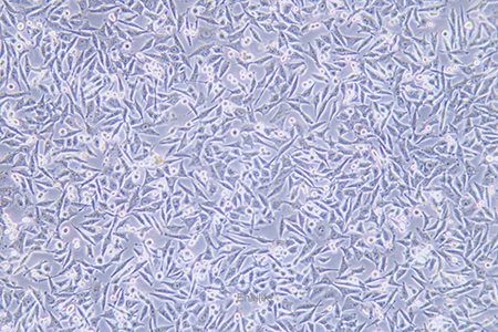 人恶性黑色素瘤细胞A375(STR鉴定) | EnkiLife恩玑生命