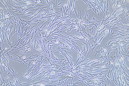 人恶性黑色素瘤细胞MeWO(STR鉴定) | EnkiLife恩玑生命