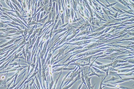 人恶性黑色素瘤细胞MeWO(STR鉴定) | EnkiLife恩玑生命