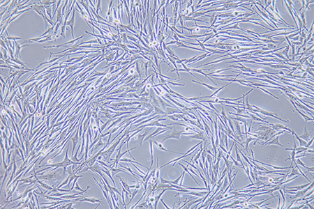 人恶性黑色素瘤细胞MeWO(STR鉴定) | EnkiLife恩玑生命