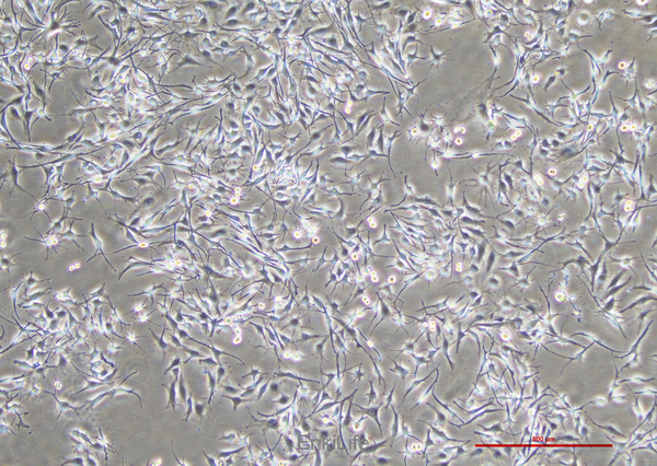 人恶性黑色素瘤细胞SK-MEL-28(STR鉴定) | EnkiLife恩玑生命