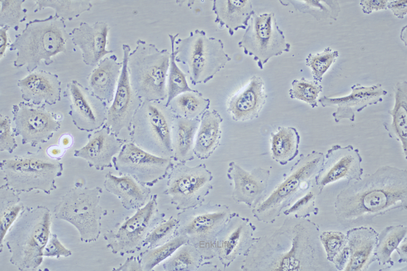 人非小细胞肺癌细胞HCC-44(STR鉴定) | EnkiLife恩玑生命