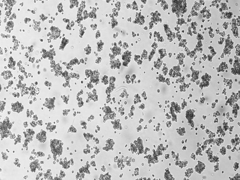 人非小细胞肺癌细胞NCI-H524(STR鉴定) | EnkiLife恩玑生命