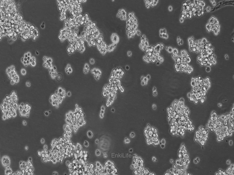 人非小细胞肺癌细胞NCI-H524(STR鉴定) | EnkiLife恩玑生命