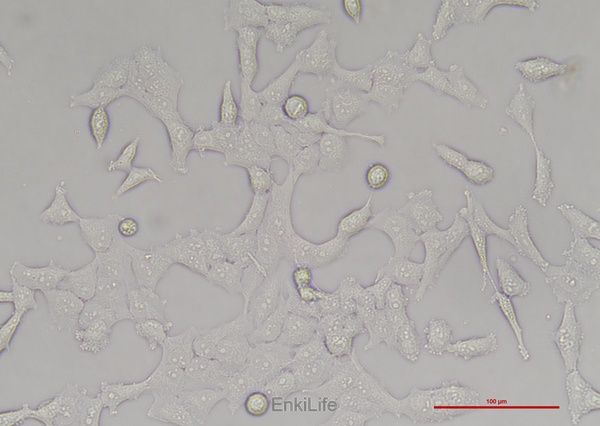 人非小细胞肺腺癌细胞NCI-H157(STR鉴定) | EnkiLife恩玑生命