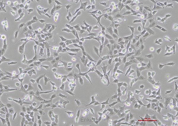 人非小细胞肺腺癌细胞NCI-H157(STR鉴定) | EnkiLife恩玑生命