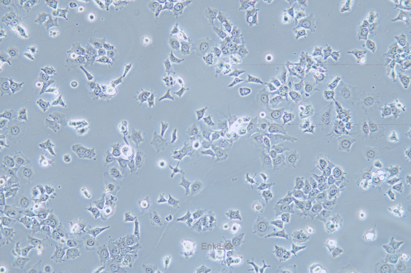 人肺鳞癌细胞HCC1588(STR鉴定) | EnkiLife恩玑生命