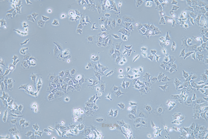 人肺鳞癌细胞HCC1588(STR鉴定) | EnkiLife恩玑生命