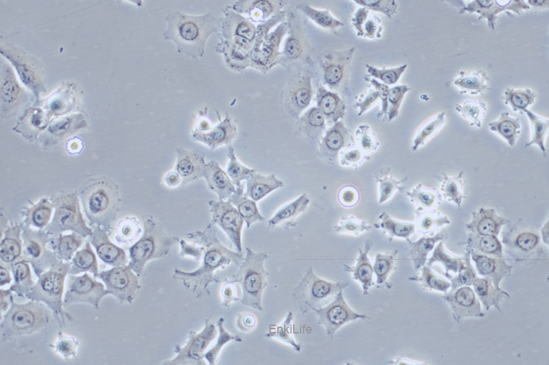 人肺鳞癌细胞HCC1588(STR鉴定) | EnkiLife恩玑生命
