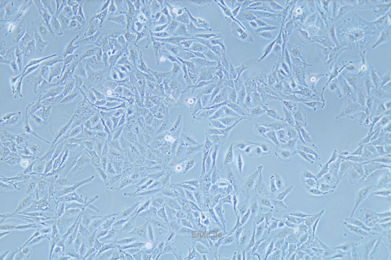 人肺腺鳞癌细胞NCI-H596(STR鉴定) | EnkiLife恩玑生命