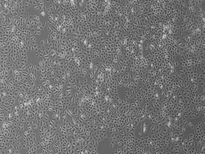 人肝癌细胞Bel-7402(STR鉴定) | EnkiLife恩玑生命